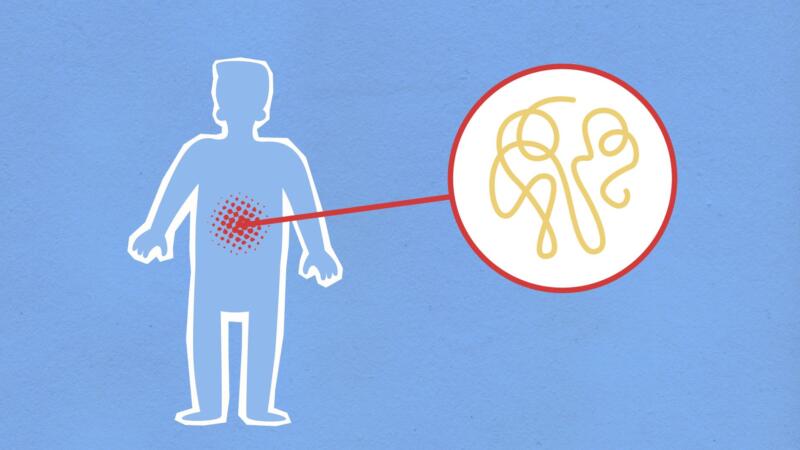 FDA approves new kind of cholesterol pill