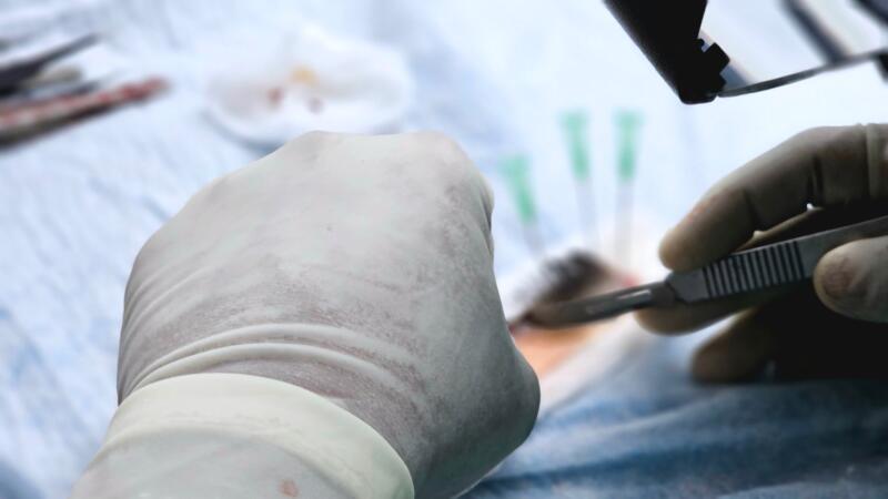  A device that revives eyeballs from dead donors could make eye transplants possible